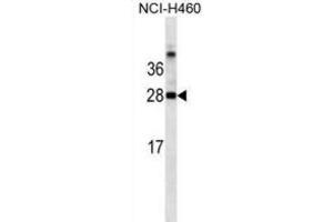 Western Blotting (WB) image for anti-Galectin 3 (LGALS3) antibody (ABIN2995387) (Galectin 3 抗体)
