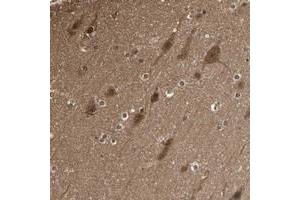 Immunohistochemical staining of human cerebral cortex with YWHAQ polyclonal antibody  shows strong cytoplasmic positivity in neuronal cells and glial cells. (YWHAB 抗体)