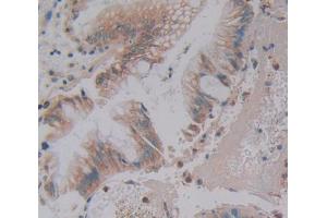 Used in DAB staining on fromalin fixed paraffin- embedded Kidney tissue (Phospholipase C beta 3, Phosphoinositide Specific (AA 318-468) 抗体)