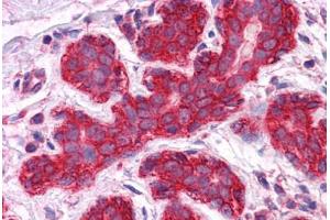 Human Breast: Formalin-Fixed, Paraffin-Embedded (FFPE) (JUP 抗体  (AA 1-746))
