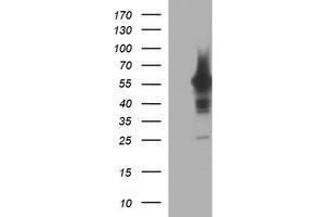 Image no. 1 for anti-Tyrosine Hydroxylase (TH) antibody (ABIN1501369) (Tyrosine Hydroxylase 抗体)