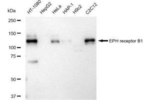 Western blotting analysis using EPH receptor B1 antibody (ABIN7798455). (Recombinant EPH Receptor B1 抗体)