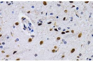 Immunohistochemistry of paraffin-embedded Rat brain using ID3 Polyclonal Antibody at dilution of 1:200 (40x lens). (ID3 抗体)