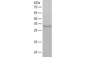 Western Blotting (WB) image for NmrA-Like Family Domain Containing 1 (NMRAL1) (AA 1-299) protein (His tag) (ABIN7288903) (NMRAL1 Protein (AA 1-299) (His tag))