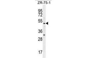 MEF2D Antibody (N-term) western blot analysis in ZR-75-1 cell line lysates (35µg/lane). (MEF2D 抗体  (N-Term))
