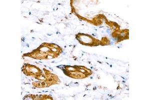 Immunohistochemistry (Paraffin-embedded Sections) (IHC (p)) image for anti-Annexin A8 (ANXA8) antibody (ABIN7073071)