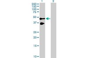 Western Blot analysis of TNFRSF10B expression in transfected 293T cell line by TNFRSF10B MaxPab polyclonal antibody. (TNFRSF10B 抗体  (AA 1-440))