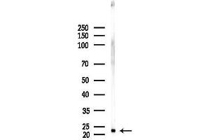 anti-Glutathione Peroxidase 4 (GPX4) (C-Term) antibody