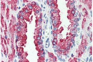 Prostate, Human: Formalin-Fixed, Paraffin-Embedded (FFPE) (GPR146 抗体  (Internal Region))
