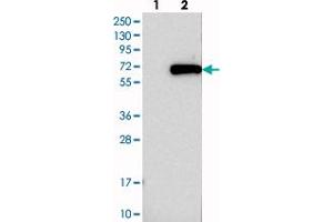 Western blot analysis of Lane 1: Negative control (vector only transfected HEK293T lysate), Lane 2: Over-expression Lysate (Co-expressed with a C-terminal myc-DDK tag (~3. (TRMT61B 抗体)