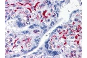 Immunohistochemistry (IHC) image for anti-Solute Carrier Family 44, Member 2 (SLC44A2) (AA 123-231) antibody (ABIN614725) (SLC44A2 抗体  (AA 123-231))