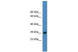 PSMD9 antibody used at 0. (PSMD9 抗体  (C-Term))