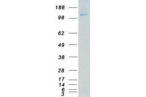 Western Blotting (WB) image for Platelet Derived Growth Factor Receptor beta (PDGFRB) (Active) protein (Myc-DYKDDDDK Tag) (ABIN2713419)