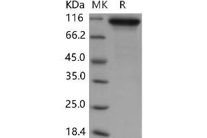 Western Blotting (WB) image for Neuroligin 1 (NLGN1) protein (His tag) (ABIN7320172) (Neuroligin 1 Protein (NLGN1) (His tag))