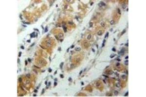Used in DAB staining on fromalin fixed paraffin-embedded Stomach tissue (CXCL17 抗体  (AA 24-119))
