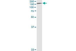 Western Blotting (WB) image for anti-Tyrosine Kinase 2 (TYK2) (AA 276-375) antibody (ABIN598992) (TYK2 抗体  (AA 276-375))