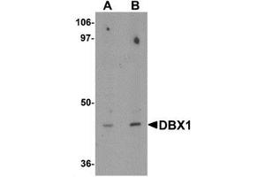 Western blot analysis of DBX1 in mouse kidney tissue lysate with DBX1 antibody at (A) 1 and (B) 2 μg/mL. (DBX1 抗体  (Middle Region))