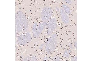 Immunohistochemistry (Paraffin-embedded Sections) (IHC (p)) image for anti-General Transcription Factor IIF, Polypeptide 2, 30kDa (GTF2F2) antibody (ABIN7074036)