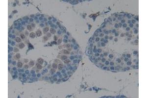 DAB staining on IHC-P; Samples: Rat Testis Tissue (CPB2 抗体  (AA 164-417))