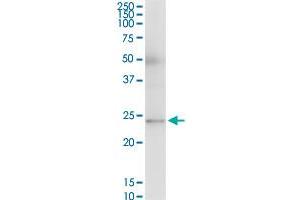 RAB23 MaxPab polyclonal antibody. (RAB23 抗体  (AA 1-237))