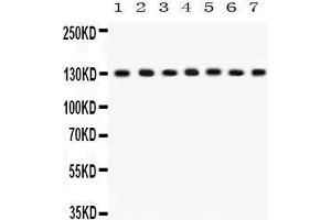 Western Blotting (WB) image for anti-Discs, Large Homolog 1 (DLG1) (AA 1-165) antibody (ABIN3043562) (DLG1 抗体  (AA 1-165))
