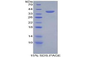 SDS-PAGE analysis of Human SPINK1 Protein.