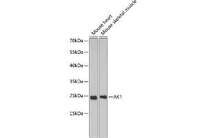 Western blot analysis of extracts of various cell lines, using  antibody (ABIN6127328, ABIN6136696, ABIN6136697 and ABIN6217467) at 1:1000 dilution. (Adenylate Kinase 1 抗体  (AA 1-194))