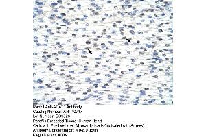 Rabbit Anti-ADAT1 Antibody  Paraffin Embedded Tissue: Human Heart Cellular Data: Myocardial cells Antibody Concentration: 4. (ADAT1 抗体  (C-Term))