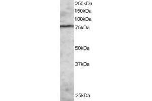 Western Blotting (WB) image for anti-Enhancer of Zeste Homolog 1 (EZH1) (N-Term) antibody (ABIN2465671) (EZH1 抗体  (N-Term))