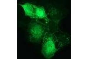 Anti-CTNNB1 mouse monoclonal antibody (ABIN2454138) immunofluorescent staining of COS7 cells transiently transfected by pCMV6-ENTRY CTNNB1 (RC208947). (CTNNB1 抗体)
