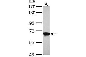 Western Blotting (WB) image for anti-Membrane Protein, Palmitoylated 2 (MAGUK P55 Subfamily Member 2) (MPP2) (Center) antibody (ABIN2855724)