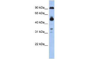WB Suggested Anti-CCDC144B Antibody Titration: 0. (CCDC144B 抗体  (Middle Region))