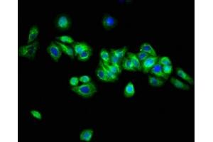 Immunofluorescence staining of HepG2 cells with ABIN7144697 at 1:133, counter-stained with DAPI. (Arylsulfatase H 抗体  (AA 449-529))