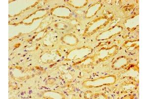 Immunohistochemistry of paraffin-embedded human kidney tissue using ABIN7146703 at dilution of 1:100 (CA12 抗体  (AA 25-301))