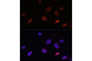 Immunofluorescence analysis of U-2 OS cells using Histone H1. (Histone H1 抗体  (AA 1-194))