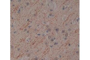 Used in DAB staining on fromalin fixed paraffin- embedded brain tissue (NT5M 抗体  (AA 38-228))