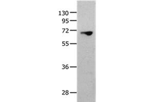 Western Blot analysis of 823 cell using MMP25 Polyclonal Antibody at dilution of 1:1300 (MMP25 抗体)