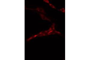 ABIN6274480 staining 293 by IF/ICC. (LMTK3 抗体)