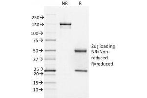 SDS-PAGE Analysis of Purified, BSA-Free FOXA1 Antibody (clone FOXA1/1518). (FOXA1 抗体  (AA 372-472))