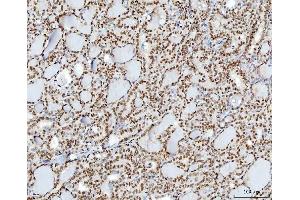 IHC analysis of YY1 using anti-YY1 antibody (ABIN7603000).