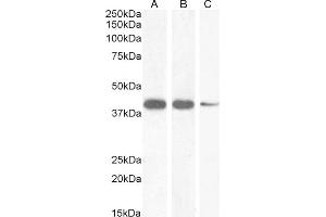 (ABIN570994) (1 μg/mL) staining of Human (A), Mouse (B) and (2 μg/mL) Rat (C) Heart lysate (35 μg protein in RIPA buffer).
