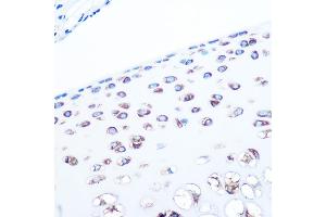 Immunohistochemistry of paraffin-embedded rat bone marrow using ALDOA Rabbit mAb (ABIN7265550) at dilution of 1:100 (40x lens). (ALDOA 抗体)