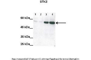 Western Blotting (WB) image for anti-serine/threonine Kinase 3 (STK3) (N-Term) antibody (ABIN2783468)