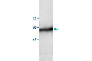 Western blot analysis of human fetal liver tissue lysate with ADAM15 polyclonal antibody  at 1:200 dilution. (ADAM15 抗体)