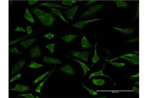 Immunofluorescence (IF) image for anti-Excision Repair Cross-Complementing Rodent Repair Deficiency, Complementation Group 2 (ERCC2) (AA 1-405) antibody (ABIN515384)