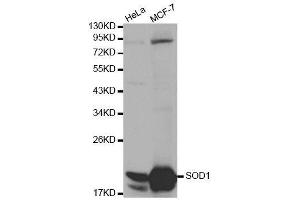 Western blot analysis of extracts of various cell lines, using SOD1 antibody. (SOD1 抗体  (AA 1-154))