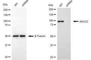 Western blotting analysis using ASCC2 antibody (ABIN7797477). (ASCC2 抗体)