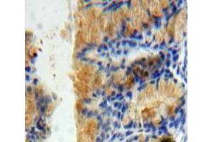 IHC-P analysis of Bowels tissue, with DAB staining. (PICK1 抗体  (AA 24-229))