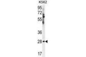 HSD11B1L Antibody Western blot analysis in K562 cell line lysates (35ug/lane). (HSD11B1L 抗体  (C-Term))