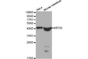 Western blot analysis of extracts of various cell lines, using KRT20 antibody. (KRT20 抗体)
